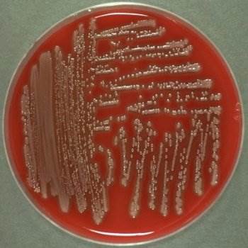Figure 1. Outcome of culture. Colonyforming units of E.coli in a Petri dish diagnosed by inspection