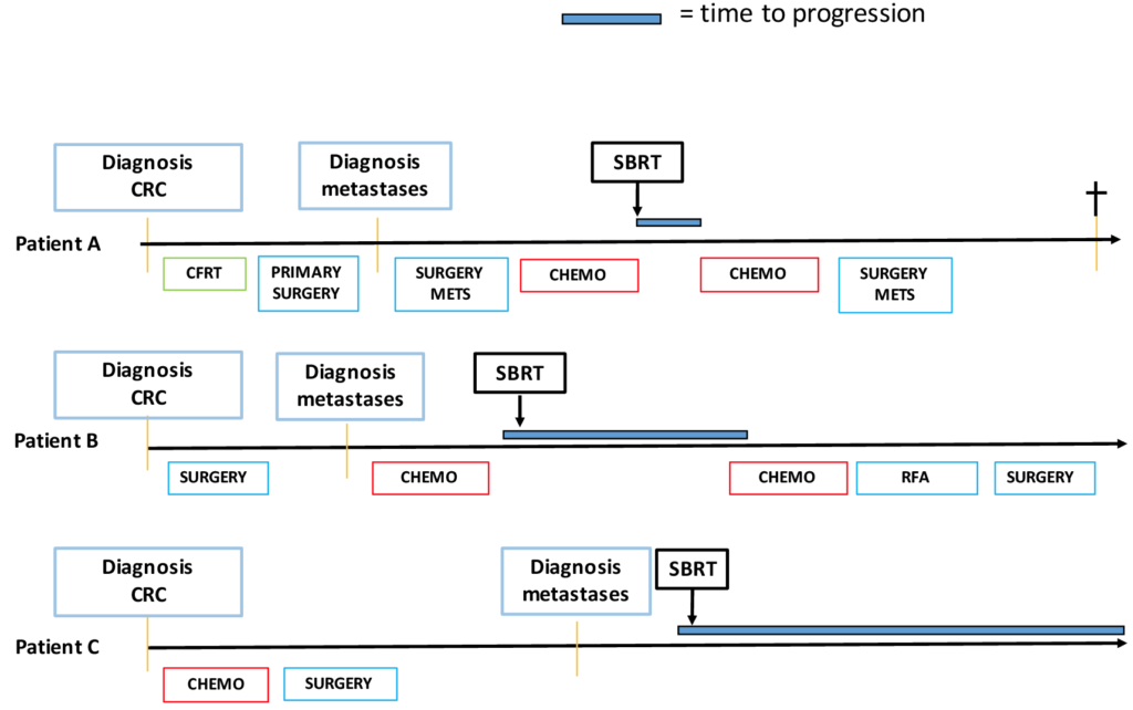 Figure I: Examples of three patients treated with SBRT for CRC metastases with different indications: as treatment beyond progression on systemic therapy (patient A), as consolidation therapy (patient B) and as upfront treatment for oligometastases (patient C).
