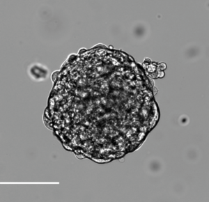 Figur 4. Ved å dyrke kreftstamceller fra glioblastom danner de ­tredimensjonale sfærer i cellekultur. Skaleringslinje 100 µm. Copyright forfatterne.