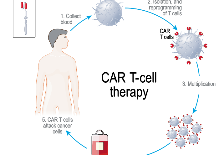 Car T-cell